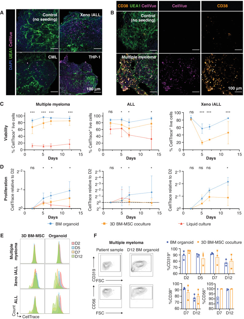 Figure 7. Bone marrow organoids support the engraftment, survival, and proliferation of cells from patients with myeloid and lymphoid hematologic malignancies. A, Organoids engrafted with CellVue-labeled model infant ALL cells from xenografts (Xeno iALL), primary cells from a patient with untreated chronic myeloid leukemia (CML) and THP-1 cells, an acute myeloid leukemia cell line. CellVue+ cells are visible throughout the volume of organoids. B, Organoids seeded with CD138+ cells isolated from bone marrow aspirates of patients with multiple myeloma show CellVue+ CD38+ plasma cell engraftment. C–E, Viability and proliferation of cells from 4 donors with multiple myeloma, 6 donors with acute lymphoblastic leukemia (ALL) and 3 Xeno iALL samples seeded simultaneously in the organoids, a 3D coculture with primary human BM-MSC (3D BM-MSC), and where possible, liquid culture. E, Serial dilution of CellTrace label, indicating cell proliferation, for multiple myeloma, Xeno iALL, and ALL cells in 3D BM-MSC and organoids on days 2, 5, 7, and 12 following thawing and plating. F, Engrafted multiple myeloma cells retained their immunophenotype at day 12, with more consistent maintenance of CD319 and CD38 in organoids than 3D BM-MSC. Representative images are shown. *, P < 0.01; **, P < 0.05; ***, P < 0.001. n = 4 for multiple myeloma, n = 3 for Xeno iALL and n = 3 for ALL, with each repeat comprised of a separate donor two-way ANOVA with repeated-measures and multiple comparisons (organoid cultures vs. 3D BM-MSC; Fisher LSD) for ALL and multiple myeloma, multiple un-paired t test for Xeno iALL data.