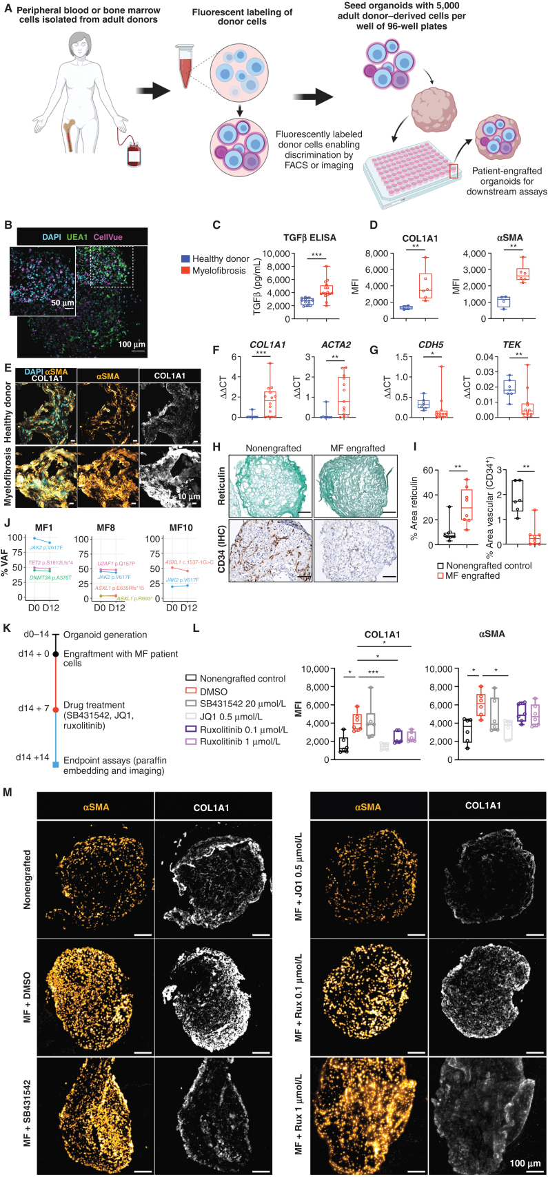 Figure 6. Engraftment of cells from patients with myelofibrosis, but not healthy donors, results in organoid “niche remodeling” and fibrosis. A, Cryopreserved peripheral blood or bone marrow cells from healthy donors and patients with blood cancers were fluorescently labeled, and 5,000 donor cells were seeded into each well of a 96-well plate containing individual organoids. B, Maximum-intensity projection of confocal Z-stack of a whole engrafted organoid 72 hours after seeding of the wells with donor cells, indicating donor cells engrafted throughout the volume of the organoids. C, Soluble TGFβ in organoids engrafted by cells from myelofibrosis patients and controls. D–G, Comparison of organoids engrafted with healthy donor and myelofibrosis cells for (D) collagen 1 (COL1A1) and αSMA immunofluorescence and (E) representative images; F, Col1A1 and ACTA2 gene expression; G, CDH5 and TIE2 expression. (*, P < 0.01; **, P < 0.05; ***, P < 0.001 for Mann–Whitney test, n = 4 healthy donors; n = 7 MF samples for qRT-PCR, n = 4 healthy donors; n = 6 MF samples for imaging and quantification of cryosections). H and I, Increased reticulin deposition with a concomitant reduction in vascular area in organoids engrafted with myelofibrosis cells vs. nonengrafted control organoids with paired t tests; each data point corresponds to a single organoid engrafted with cells from 3 donors. J, Variant allele frequencies of mutations detected by NGS of cells from myelofibrosis patients before seeding in organoids (day 0) compared with cells isolated by flow cytometry 12 days after culture in organoids, indicating maintenance of clonal architecture. K, Workflow for organoid generation, engraftment with cells from myelofibrosis (MF) patients, and treatment with inhibitors. L, αSMA and collagen 1 expression in nonengrafted organoids, and organoids engrafted with myelofibrosis cells treated with DMSO (control), SB431542, JQ1, and ruxolitinib. Each data point corresponds to total measurements per organoid within a block (n = 3 donors). One-way ANOVA with multiple comparisons (Fisher LSD). M, Representative images from (L). Schematic in A created on Biorender.com. *, P < 0.01; **, P < 0.05; ***, P < 0.001. See also Supplementary Fig. S8.