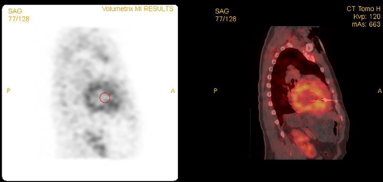 Fig 4