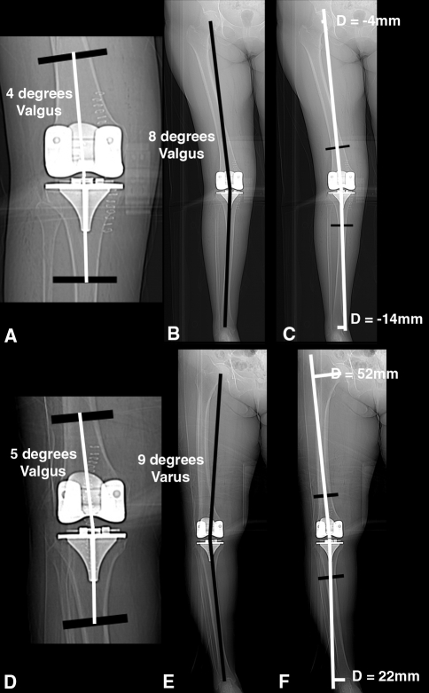 Fig. 6A–F