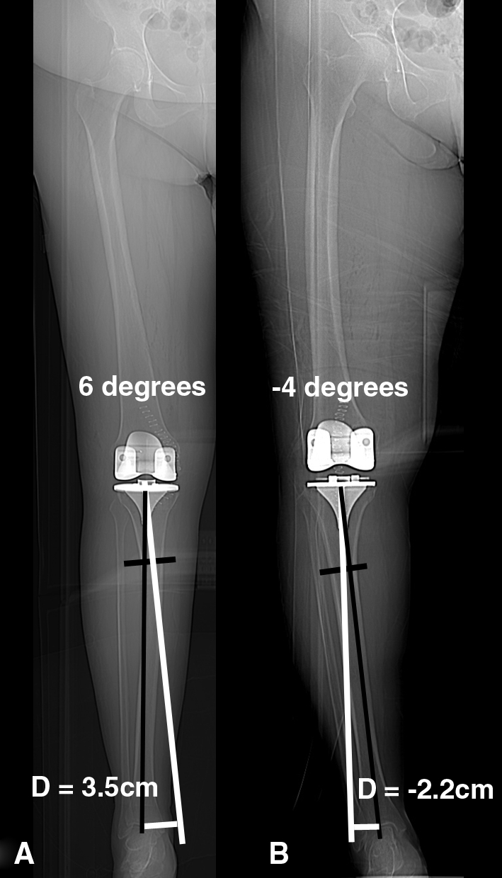 Fig. 1A–B