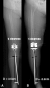 Fig. 1A–B