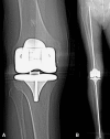 Fig. 5A–B