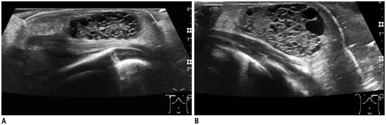 Fig. 11