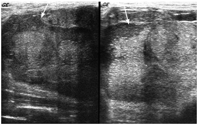 Fig. 18