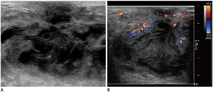 Fig. 12