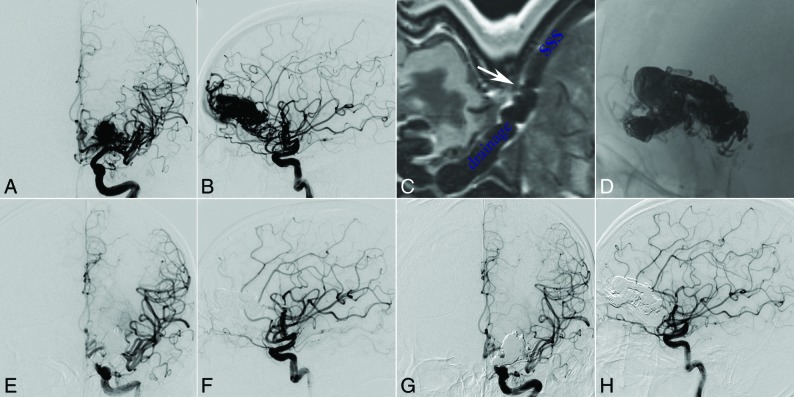 Fig 1.