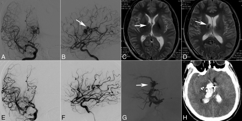 Fig 3.