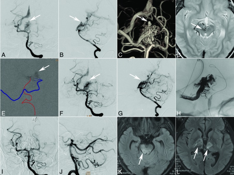 Fig 4.