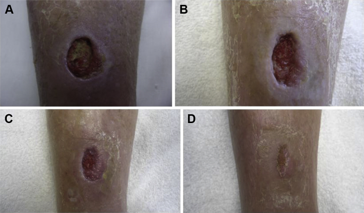 Figure 1