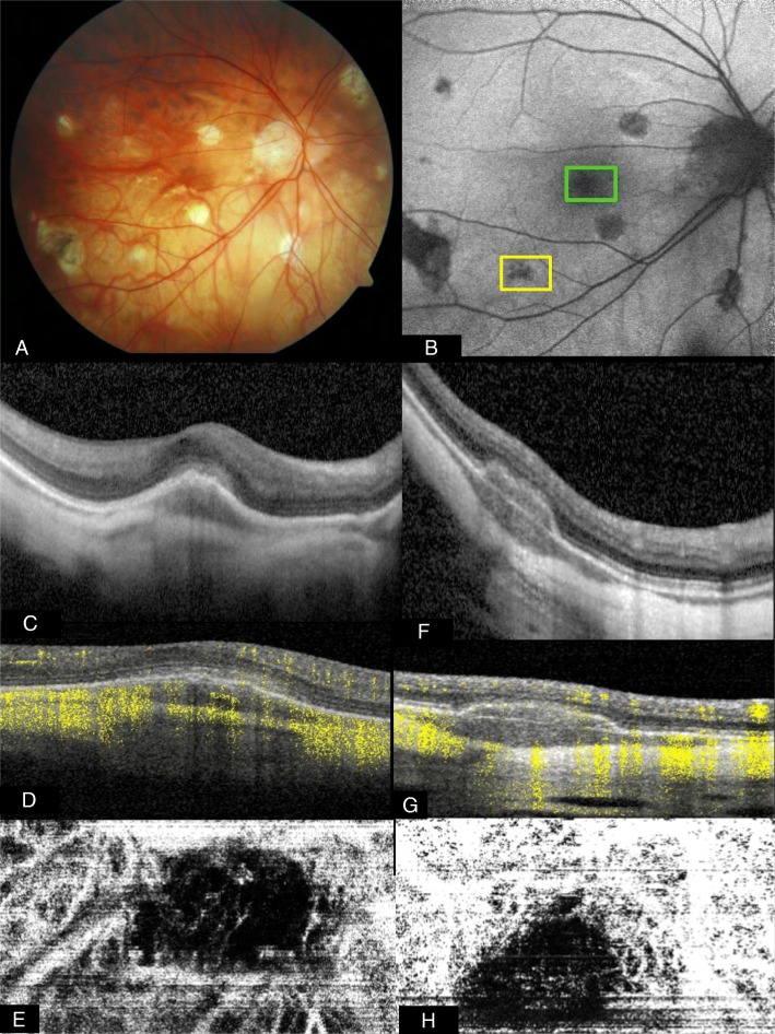 Fig. 4