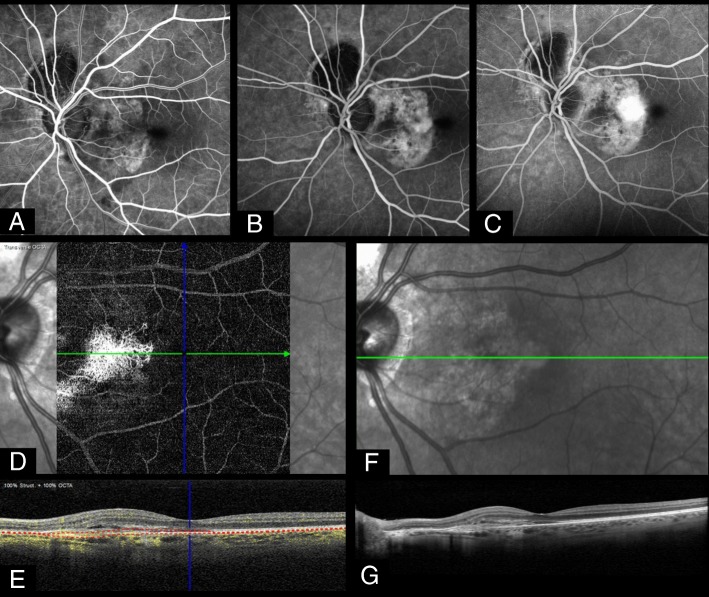 Fig. 2