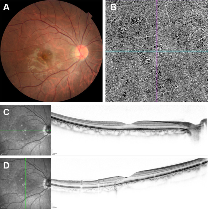 Fig. 2