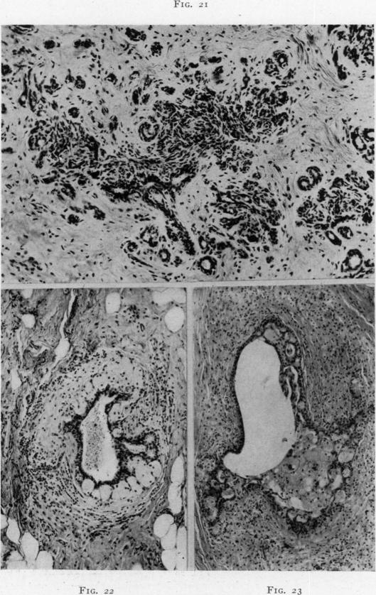 Fig. 21., Fig. 22., Fig. 23.