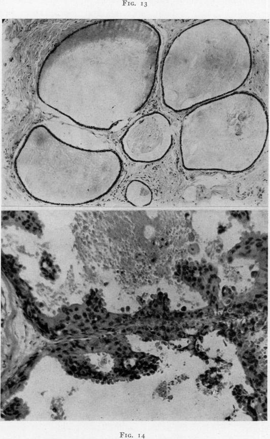 Fig. 13., Fig. 14.