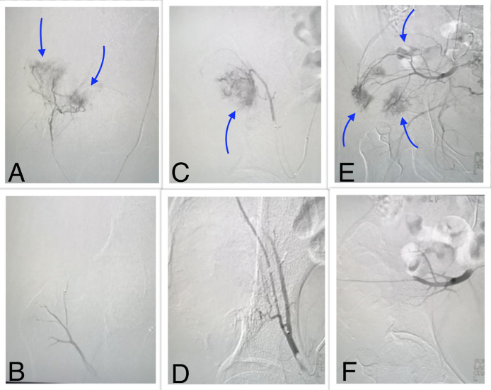 Fig 3: