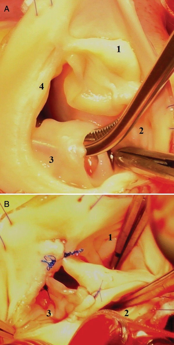 Figure 2: