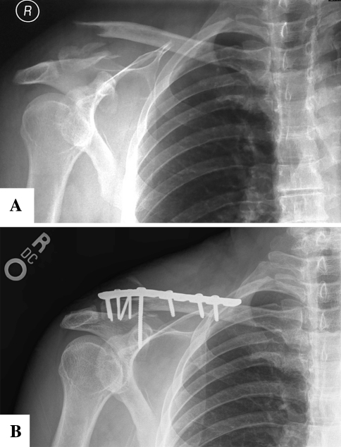 Fig. 3A–B