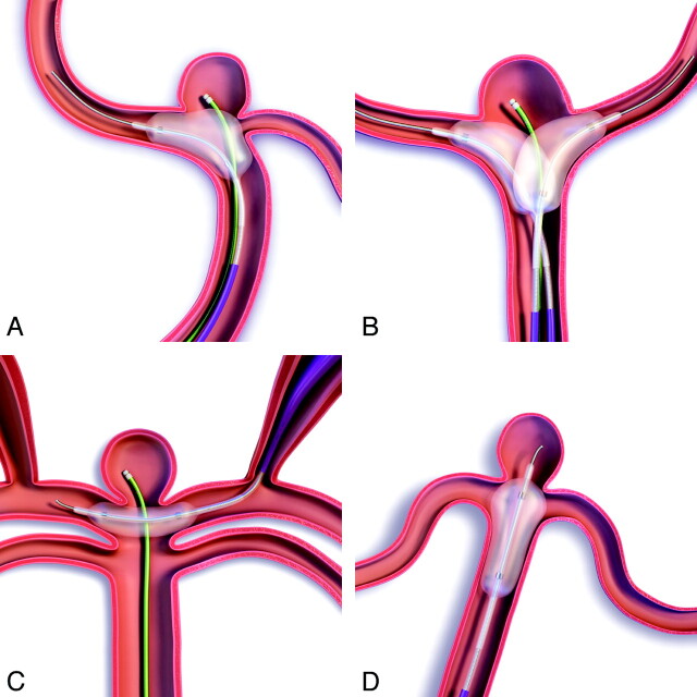 Fig 2.