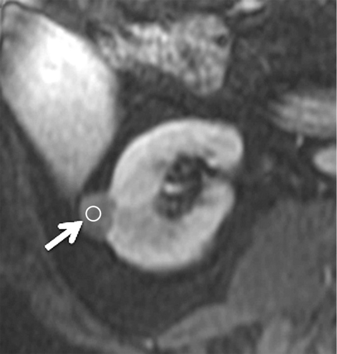 Figure 4c: