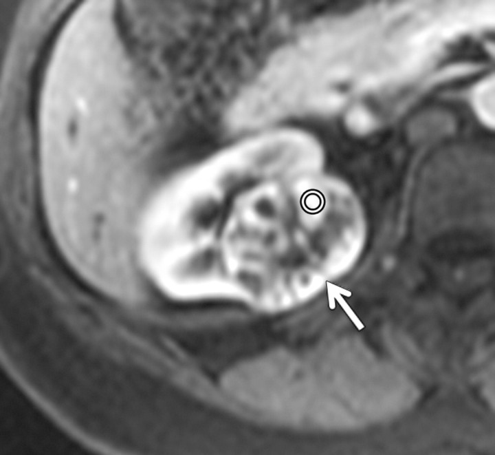 Figure 3b: