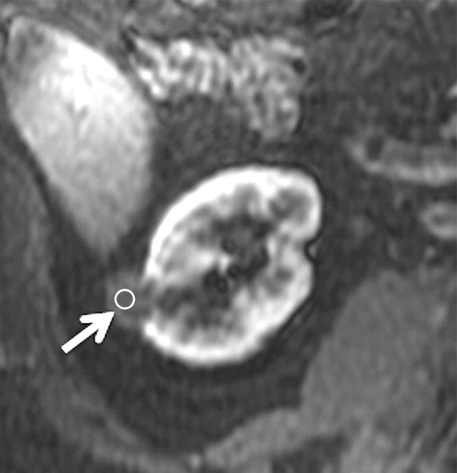 Figure 4b: