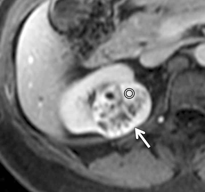 Figure 3c: