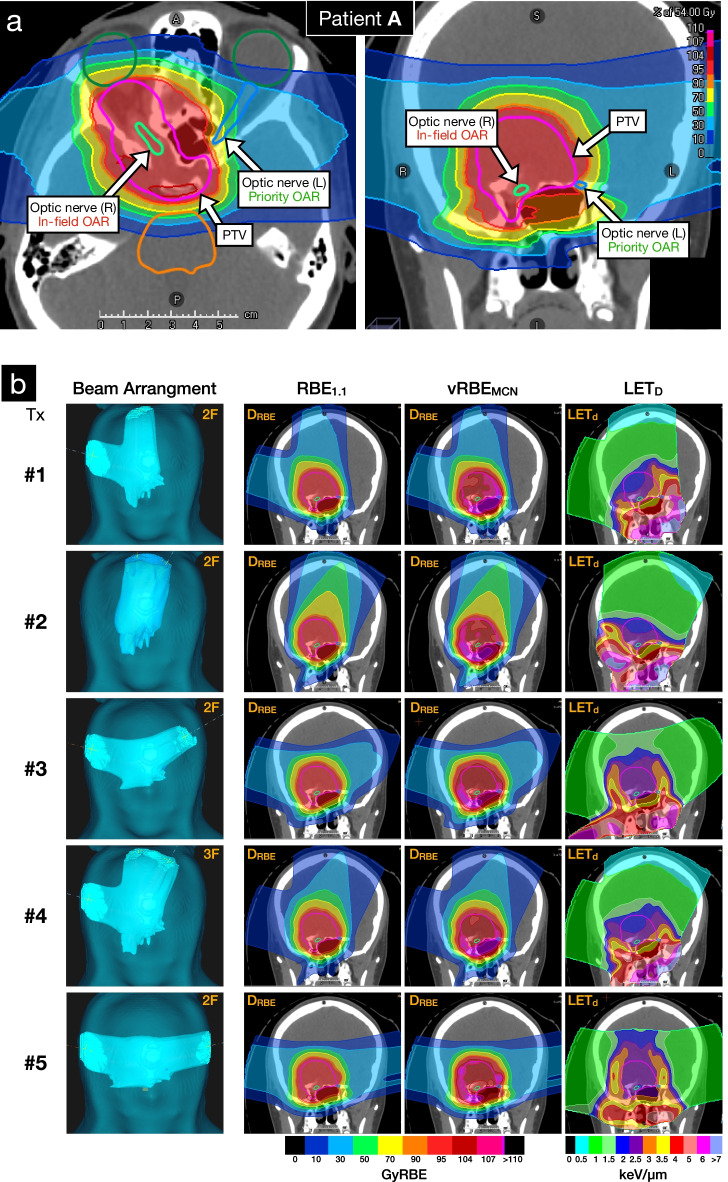 Fig. 4