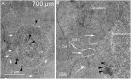 Fig 14