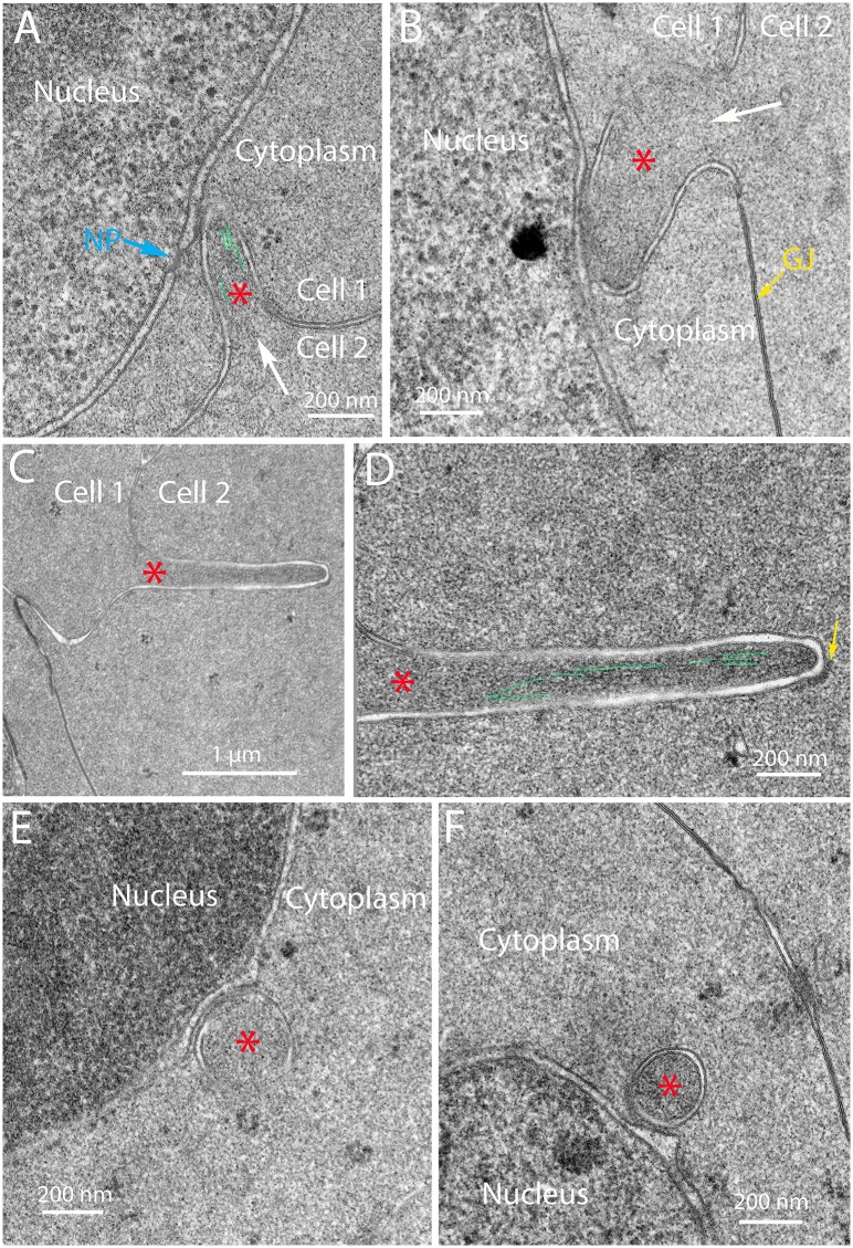 Fig 12