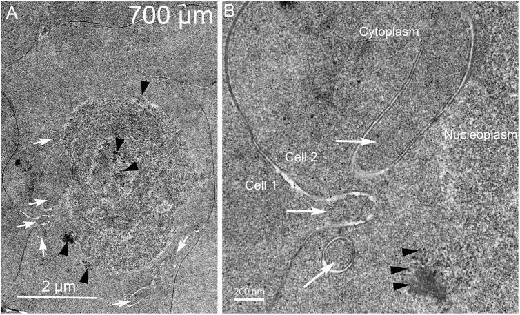 Fig 14