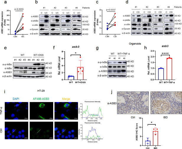 Graphs and immunoblot analyses depict ASB3 expression in UC and CD patients, DSS-treated mice, and organoids. Includes mRNA fold changes, protein levels, fluorescence in HT-29 cells, and IHC in control and IBD tissues with scoring.