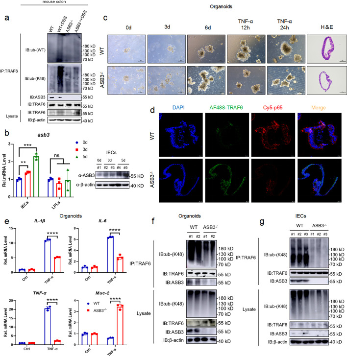 Western blots and immunoprecipitations of mouse colon tissues and organoids depict ASB3, TRAF6, and ubiquitin interactions. Expression levels of ASB3, IL-1β, IL-6, TNF-α, and Muc-2 in various conditions.