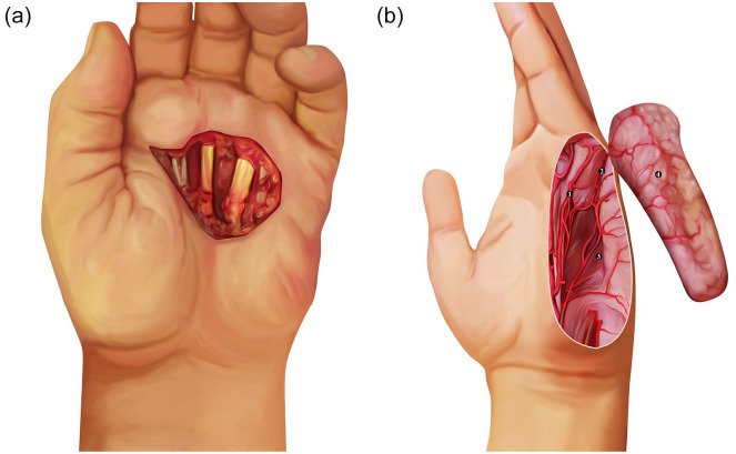 Figure 1.