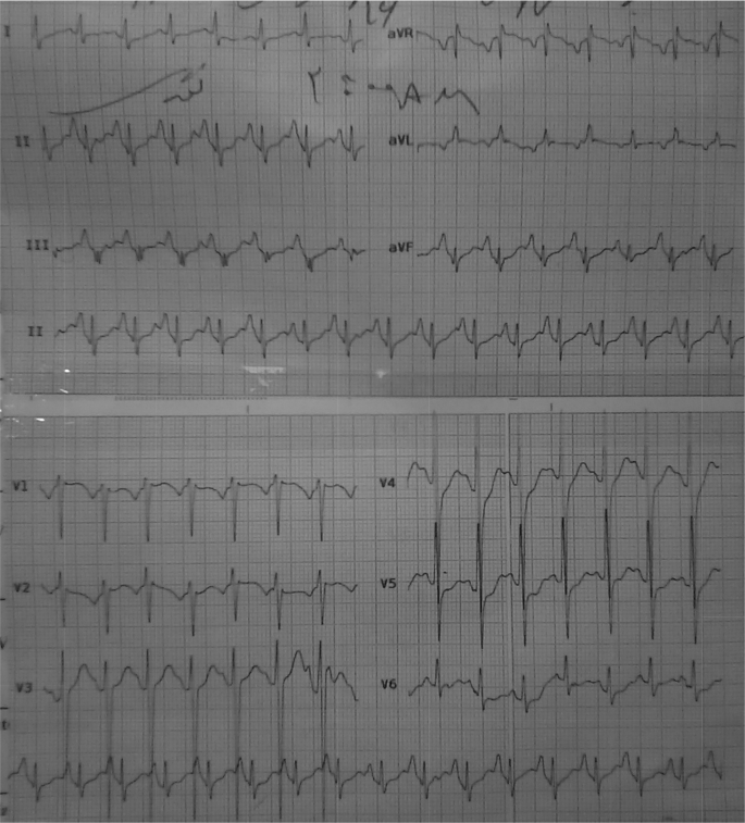 Fig. 2