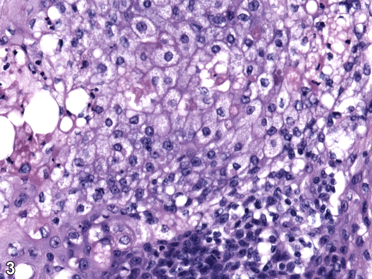 Fig 3