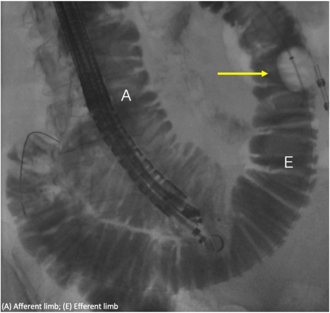 Figure 3