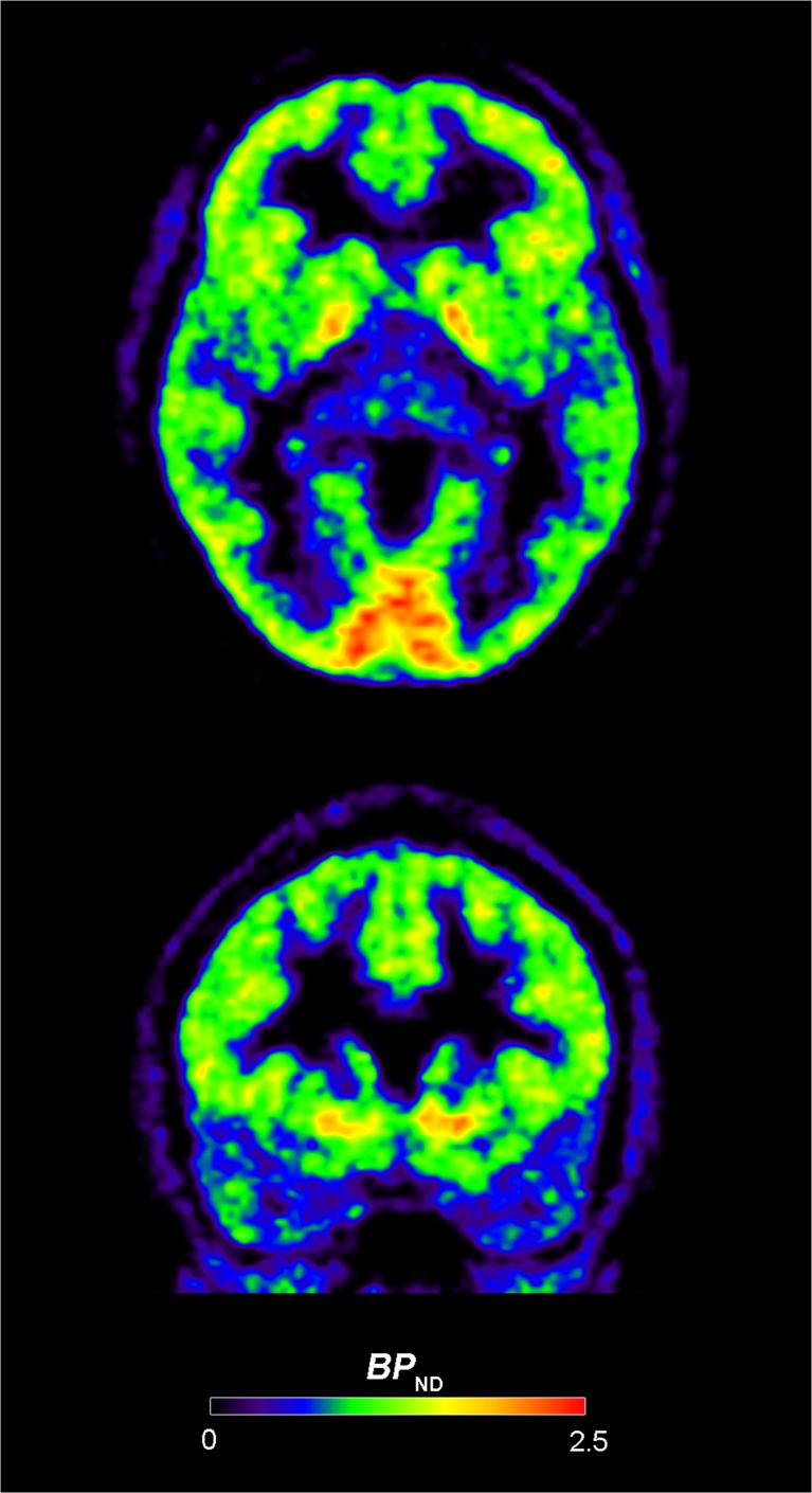 Fig. 2