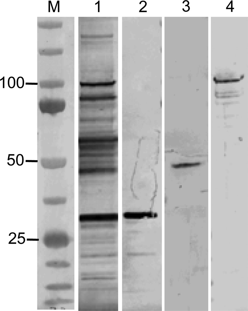 FIG. 1