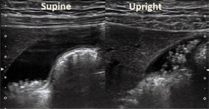 Fig. 17.