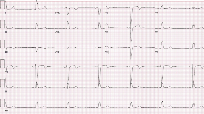 Figure 2