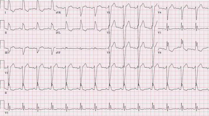 Figure 1