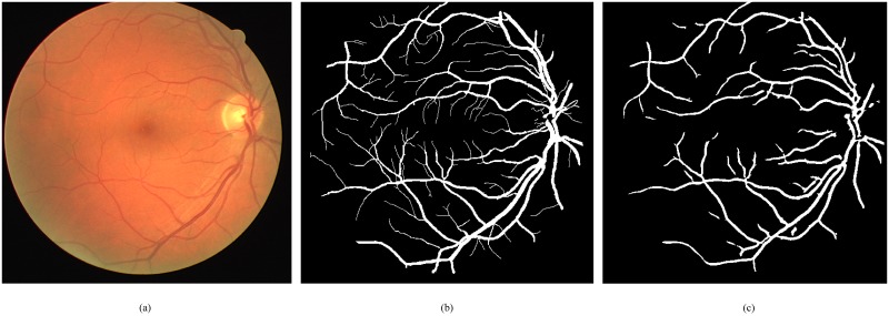 Fig 12