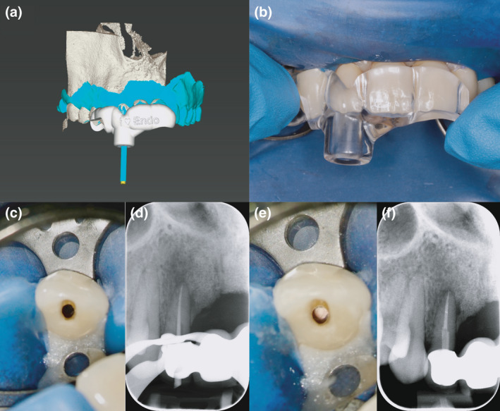 FIGURE 2