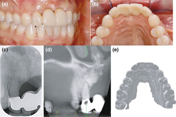 FIGURE 1