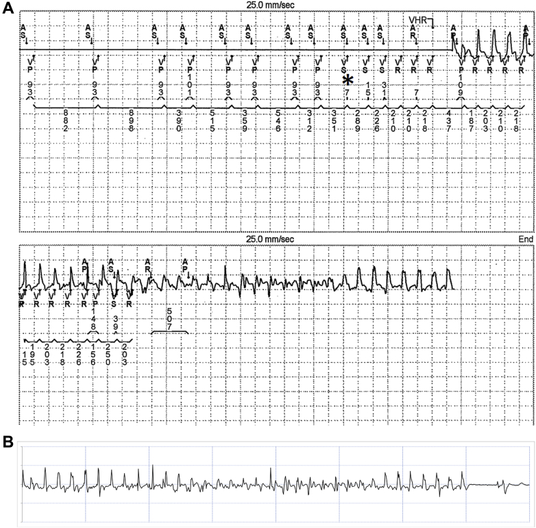 Figure 1