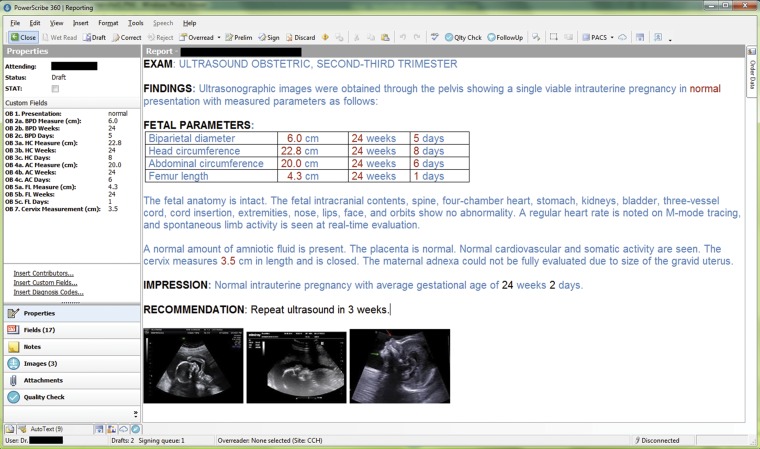 Figure 17.