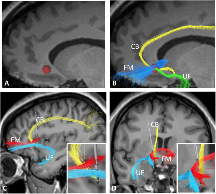 Fig. 1.