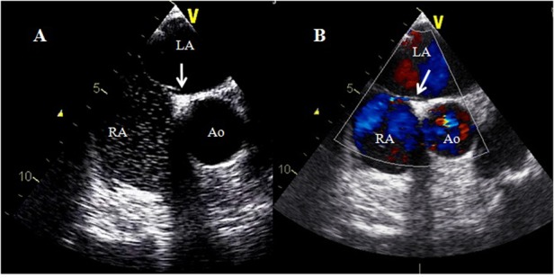 Figure 4