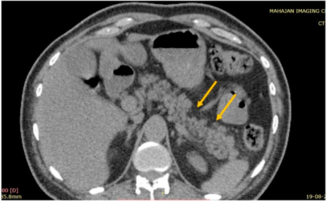 Fig. 1